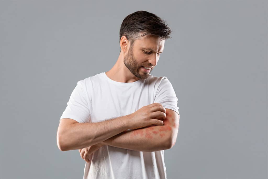 Vita D3 Benefits: 10 Amazing Things You Need To Know 6 vitamin D3 benefits psoriasis