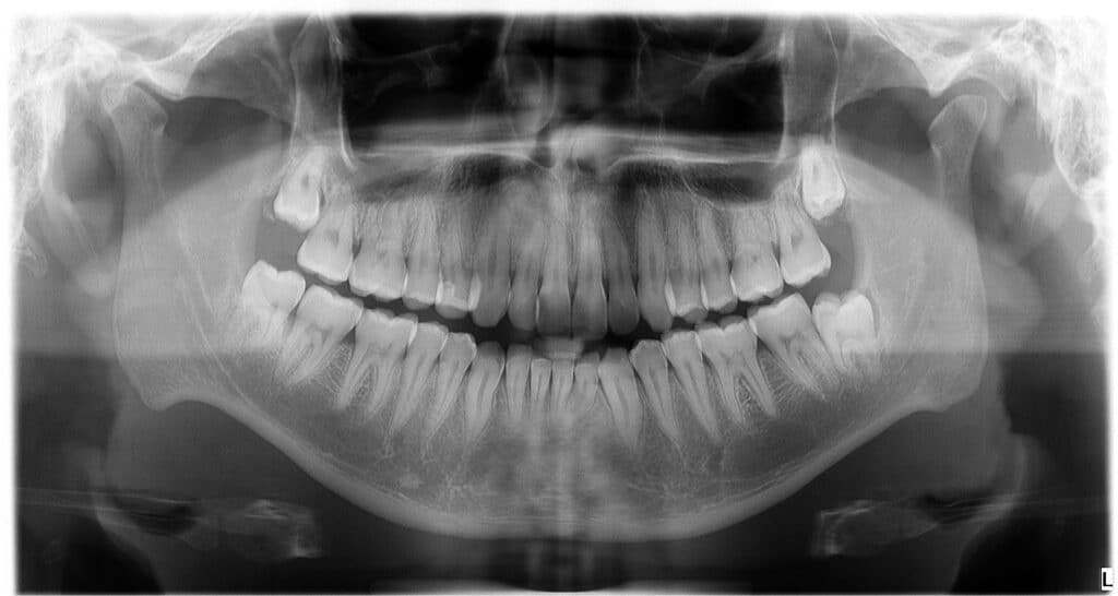 What are Teeth Made of? 2023 Latest Best Science 1 what are teeth made of